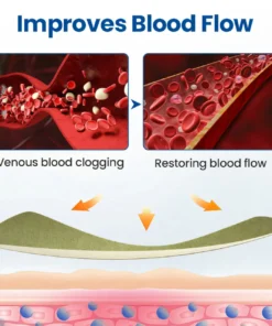 Cvreoz® Varicose Veins Patch