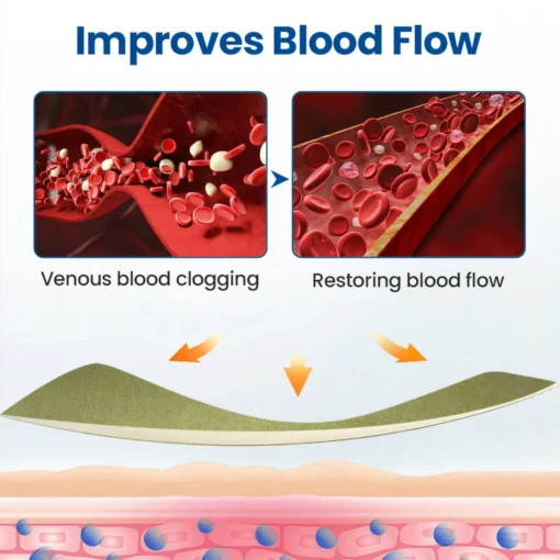 Cvreoz® Varicose Veins Patch