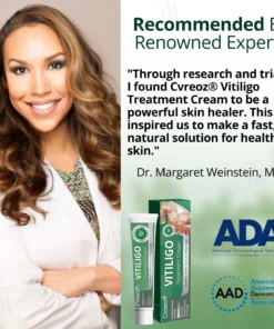 Cvreoz® Vitiligo Treatment Cream