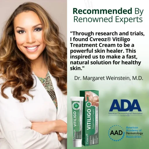 Cvreoz® Vitiligo Treatment Cream