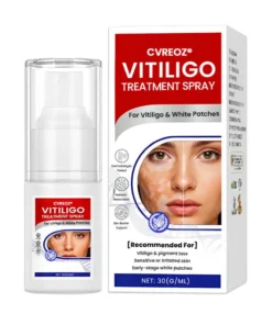 Cvreoz® Vitiligo Treatment Spray