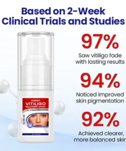 Cvreoz® Vitiligo Treatment Spray