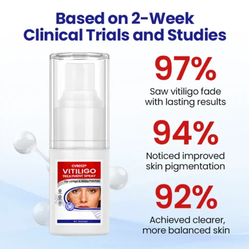 Cvreoz® Vitiligo Treatment Spray