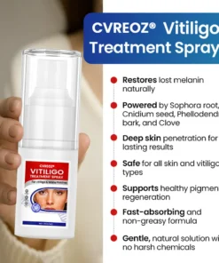 Cvreoz® Vitiligo Treatment Spray