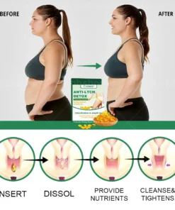 Cvreoz®Anti-ltch Detox Slimming Capsule