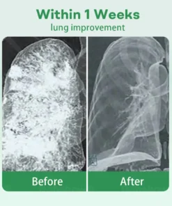 𝐂𝐯𝐫𝐞𝐨𝐳® 𝐇𝐞𝐫𝐛𝐚𝐥 𝐋𝐮𝐧𝐠 𝐂𝐥𝐞𝐚𝐧𝐬𝐢𝐧𝐠 𝐈𝐧𝐡𝐚𝐢𝐞𝐫