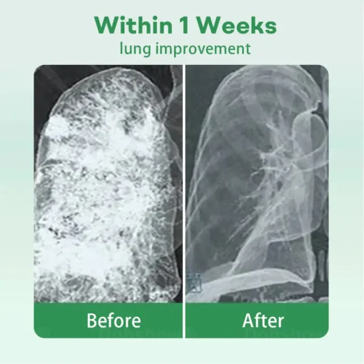 𝐂𝐯𝐫𝐞𝐨𝐳® 𝐇𝐞𝐫𝐛𝐚𝐥 𝐋𝐮𝐧𝐠 𝐂𝐥𝐞𝐚𝐧𝐬𝐢𝐧𝐠 𝐈𝐧𝐡𝐚𝐢𝐞𝐫