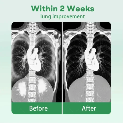𝐂𝐯𝐫𝐞𝐨𝐳® 𝐇𝐞𝐫𝐛𝐚𝐥 𝐋𝐮𝐧𝐠 𝐂𝐥𝐞𝐚𝐧𝐬𝐢𝐧𝐠 𝐈𝐧𝐡𝐚𝐢𝐞𝐫