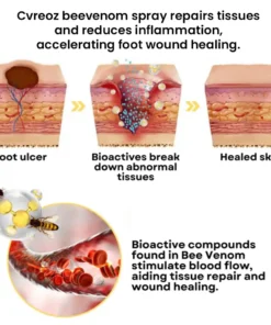 CVREOZ® Bee Venom Diabetic Foot Healing Spray