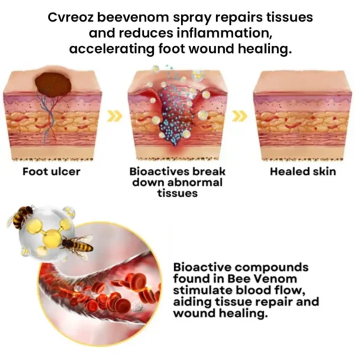 CVREOZ® Bee Venom Diabetic Foot Healing Spray