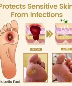 CVREOZ® Bee Venom Diabetic Foot Healing Spray