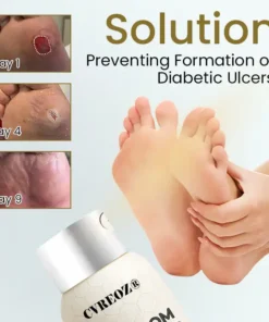 CVREOZ® Bee Venom Diabetic Foot Healing Spray