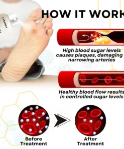 CVREOZ® Bee Venom Diabetic Foot Healing Spray