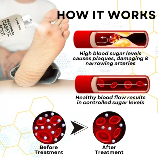 CVREOZ® Bee Venom Diabetic Foot Healing Spray