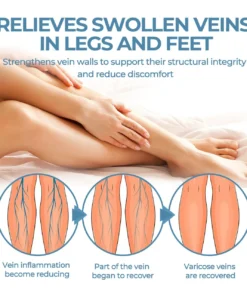 CVREOZ® Herbal Relief Varicose Vein Spray