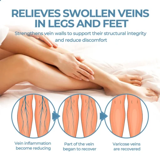 CVREOZ® Herbal Relief Varicose Vein Spray