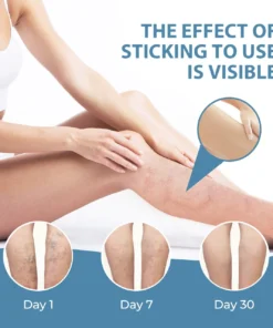 CVREOZ® Herbal Relief Varicose Vein Spray