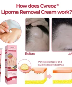 CVREOZ® LumpCure Lipoma Cream