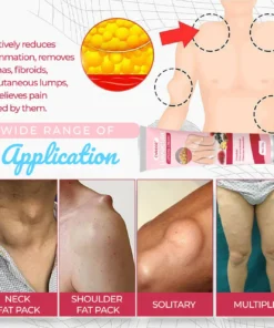 CVREOZ® LumpCure Lipoma Cream