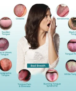 CVREOZ® OralGuard Tongue Repair Spray
