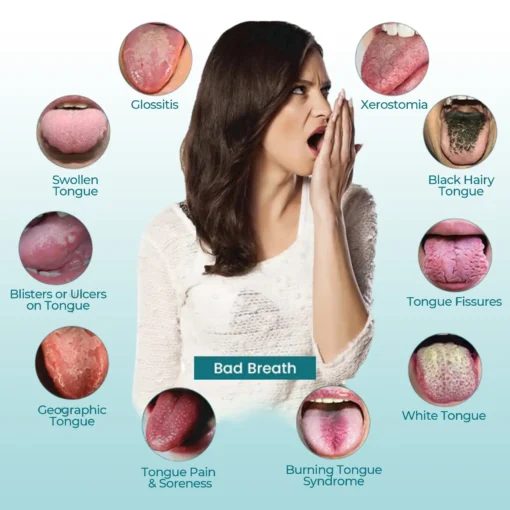CVREOZ® OralGuard Tongue Repair Spray