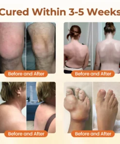 CVREOZ® Premium Curcumin Pain Relief Gel