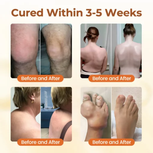 CVREOZ® Premium Curcumin Pain Relief Gel