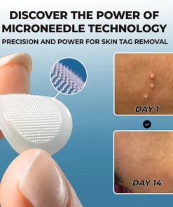 CVREOZ® Skin Tag Patches Mole & Wart Remover