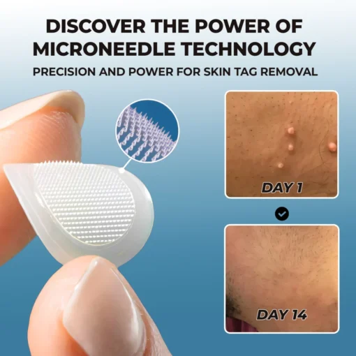 CVREOZ® Skin Tag Patches Mole & Wart Remover