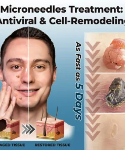 CVREOZ® Skin Tag Patches Mole & Wart Remover