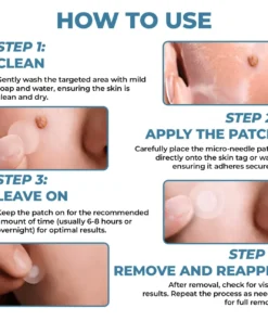 CVREOZ® Skin Tag Patches Mole & Wart Remover