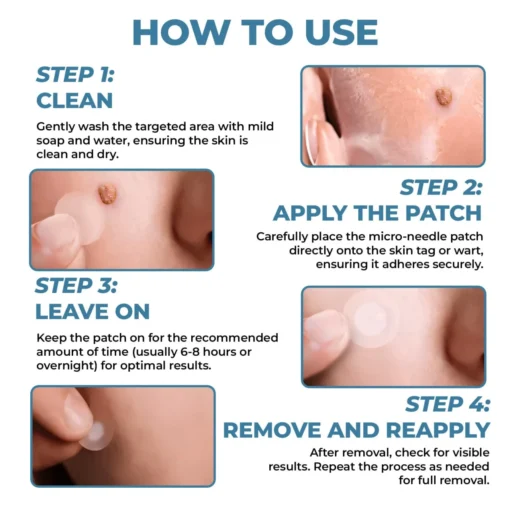 CVREOZ® Skin Tag Patches Mole & Wart Remover