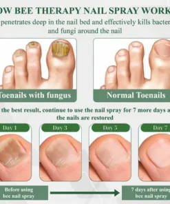 Cvreoz® 7 days Nail Fungus Renewal Herbal Spray