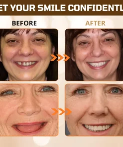 Cvreoz® Adsorptive denture