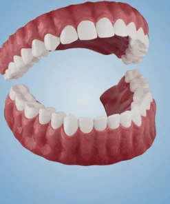 Cvreoz® Adsorptive denture