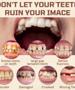 Cvreoz® Adsorptive denture