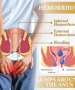 Cvreoz® Apis Venom Hemorrhoid Cooling Spray