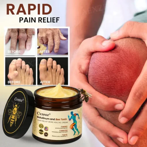Cvreoz® Botulinum and Bee Toxin Pain Relief Bone Healing Cream