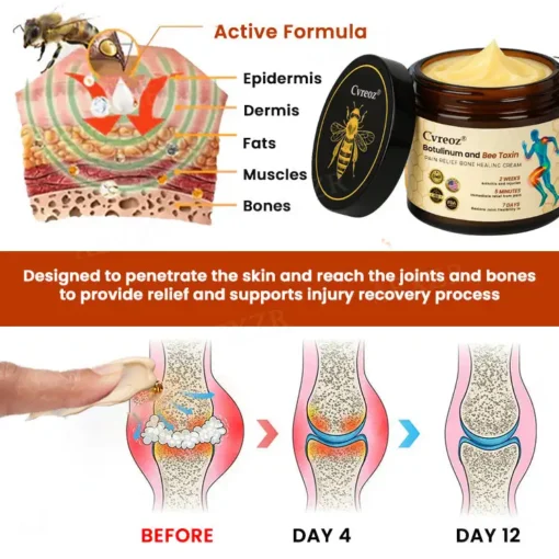 Cvreoz® Botulinum and Bee Toxin Pain Relief Bone Healing Cream