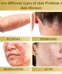 Cvreoz® Condense Mellifera Venom Skin Repairing Cream