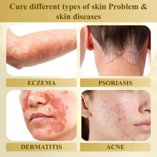 Cvreoz® Condense Mellifera Venom Skin Repairing Cream