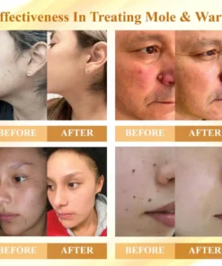 Cvreoz® Condense Mellifera Venom Skin Repairing Cream