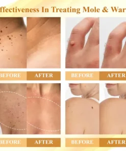 Cvreoz® Condense Mellifera Venom Skin Repairing Cream