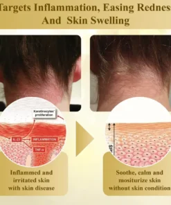 Cvreoz® Condense Mellifera Venom Skin Repairing Cream