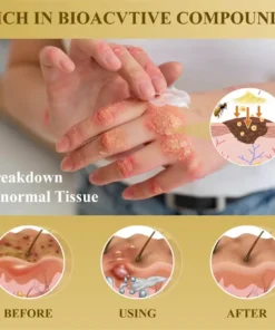Cvreoz® Condense Mellifera Venom Skin Repairing Cream