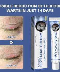 Cvreoz® HPV Facial Filiform Warts Removal Cream