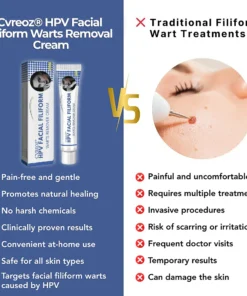 Cvreoz® HPV Facial Filiform Warts Removal Cream