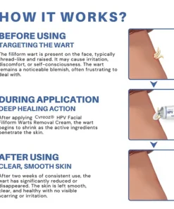 Cvreoz® HPV Facial Filiform Warts Removal Cream