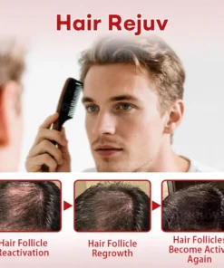 Cvreoz® Hair Regrowth System