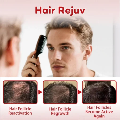 Cvreoz® Hair Regrowth System